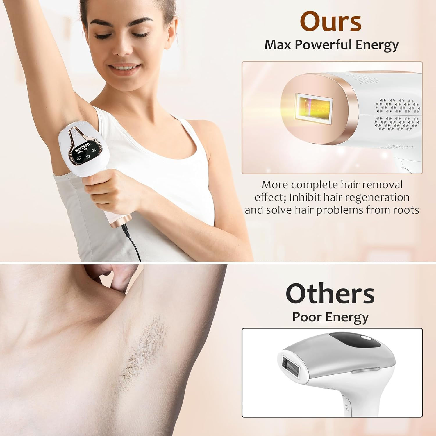 Ipl Epilasyon Lazer Epilatör 9 - Opt Ipl Laser Hair Removal Machine incelemesi ve fiyatı