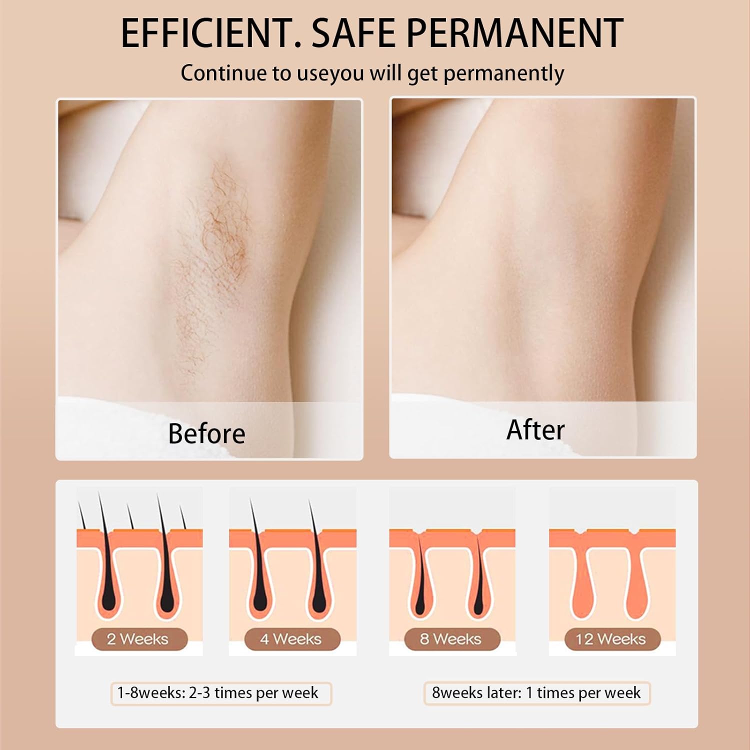 Ipl Epilasyon Lazer Epilatör 9 - Opt Ipl Laser Hair Removal Machine incelemesi ve fiyatı