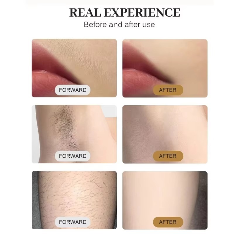 808nm Diyot Lazer Epilasyon Ci - Cooling Gel For Laser Hair Removal incelemesi ve fiyatı