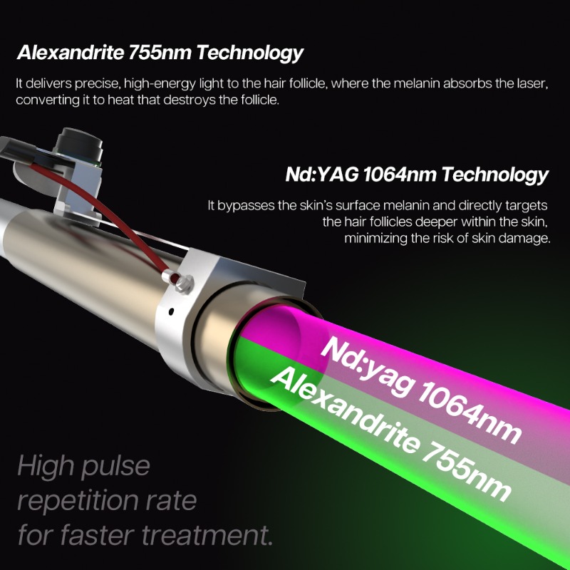 1064Nm Uzun Atımlı Nd Yag Laze - Alexandrite Laser Hair Removal Machine incelemesi ve fiyatı