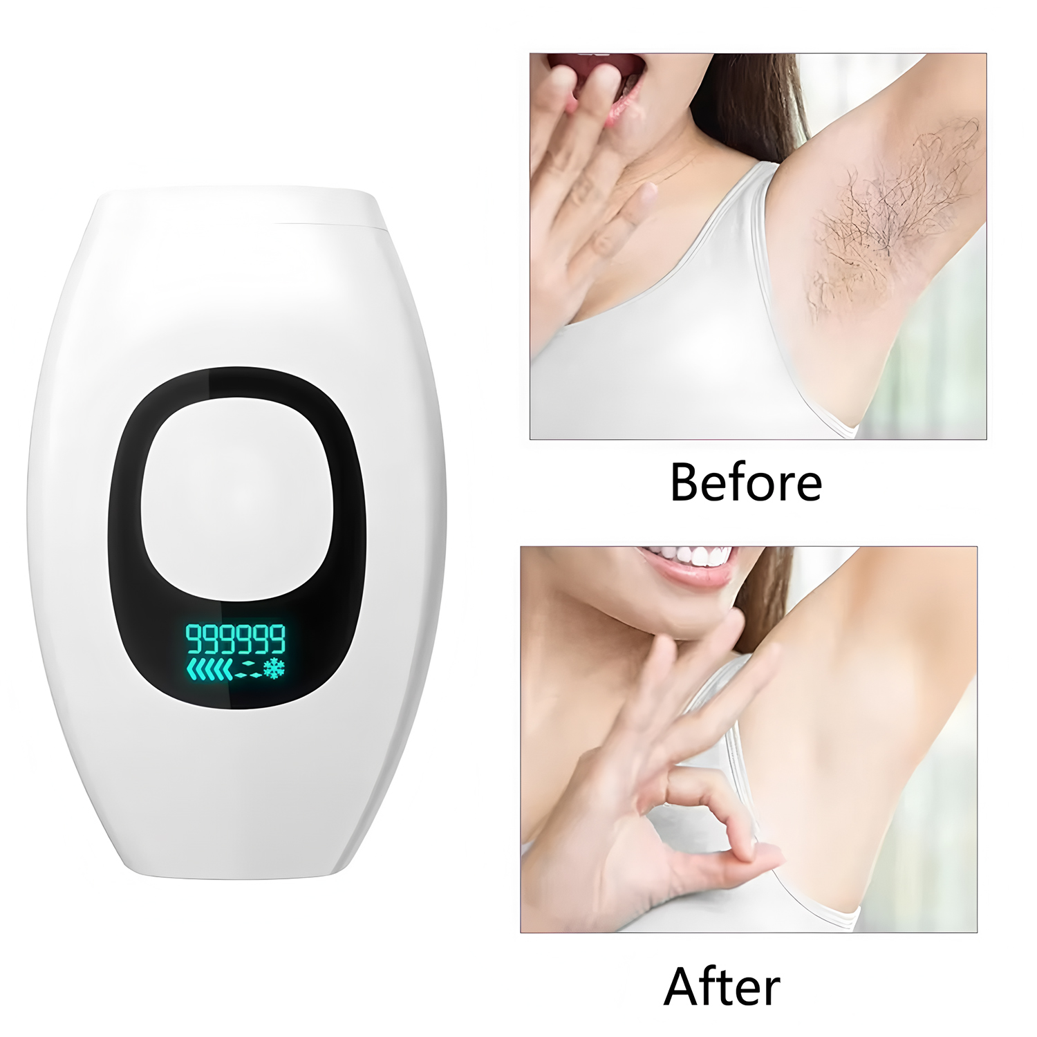Dijital Ekran IPL 500.000 Flaş - Opt Ipl Laser Hair Removal Machine incelemesi ve fiyatı