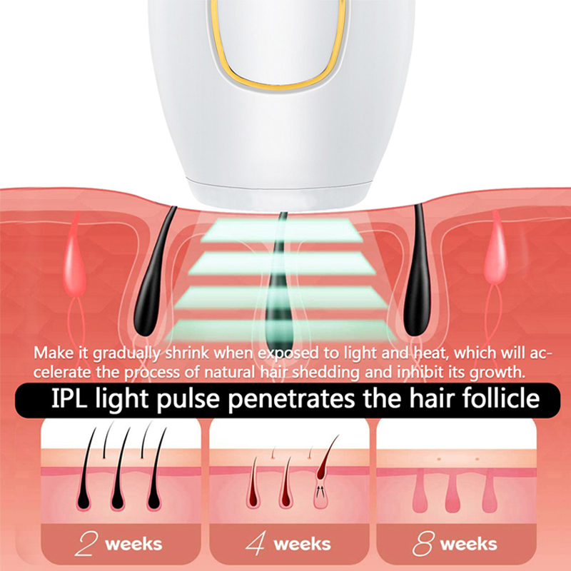 Profesyonel Kalıcı Lazer Epila - Ipl Hair Removal Handset Permanent incelemesi ve fiyatı
