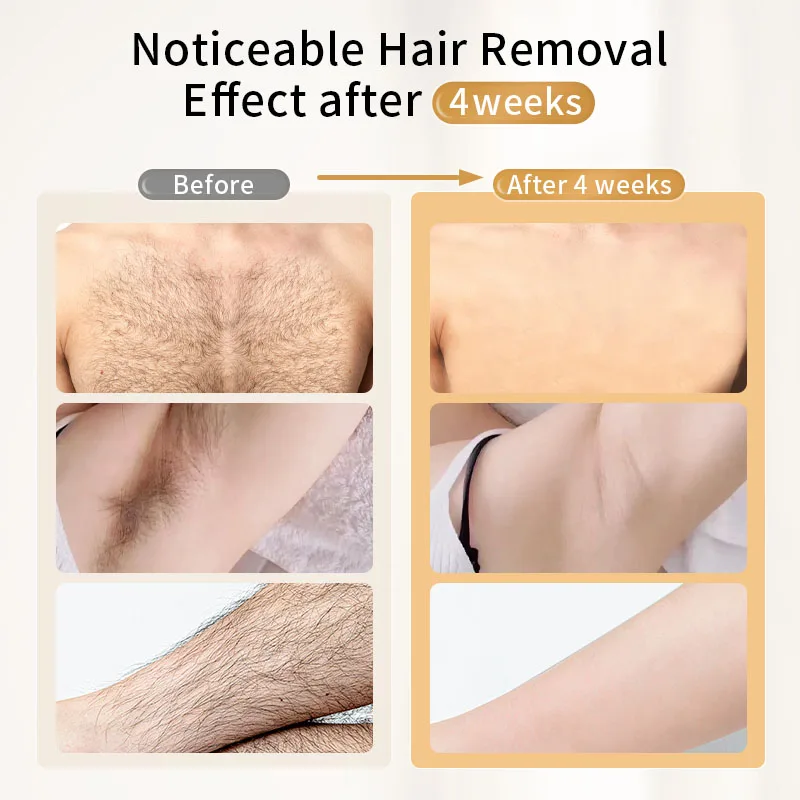 T001 48W Lazer Epilasyon Cihaz - Ipl Hair Removal Handset Permanent incelemesi ve fiyatı