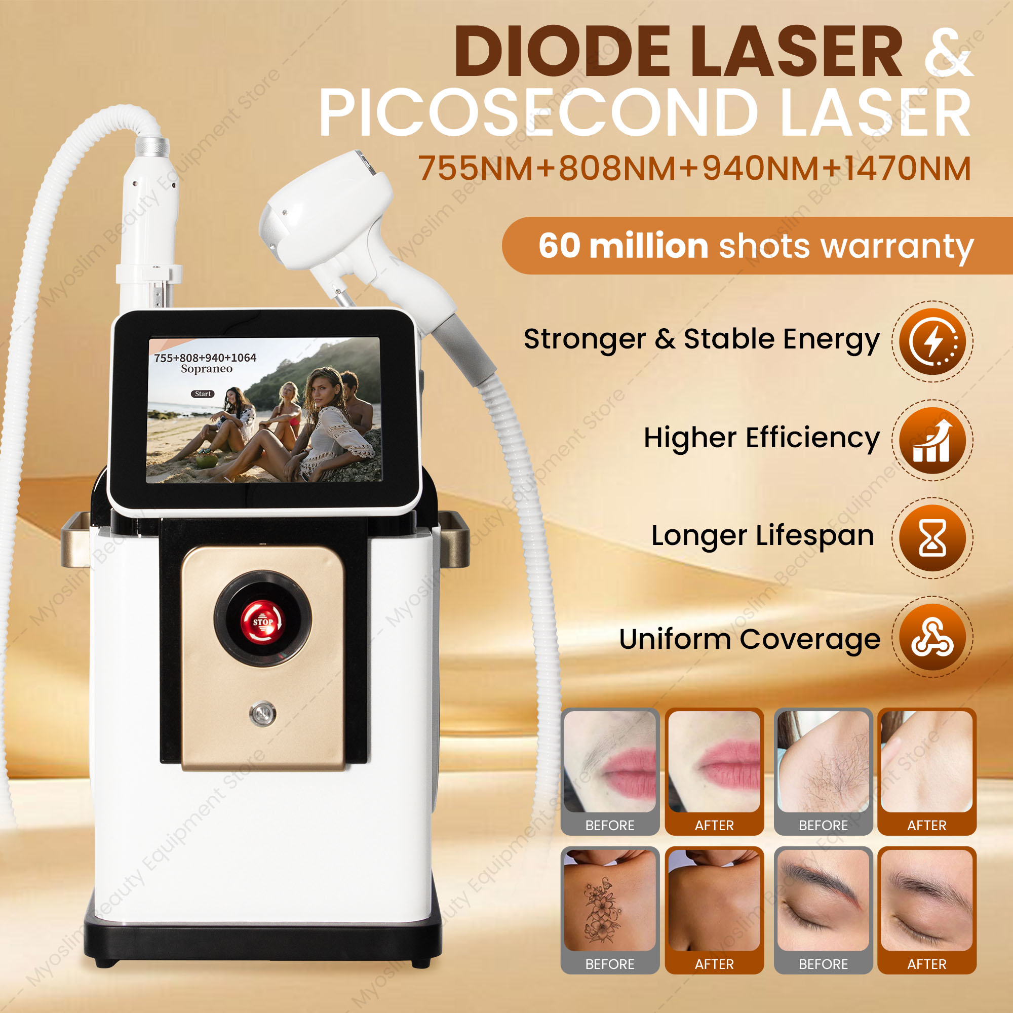İki Farklı Dalga Boyunda (755n - Diode Laser Hair Removal 808Nm 755Nm 1064Nm incelemesi ve fiyatı
