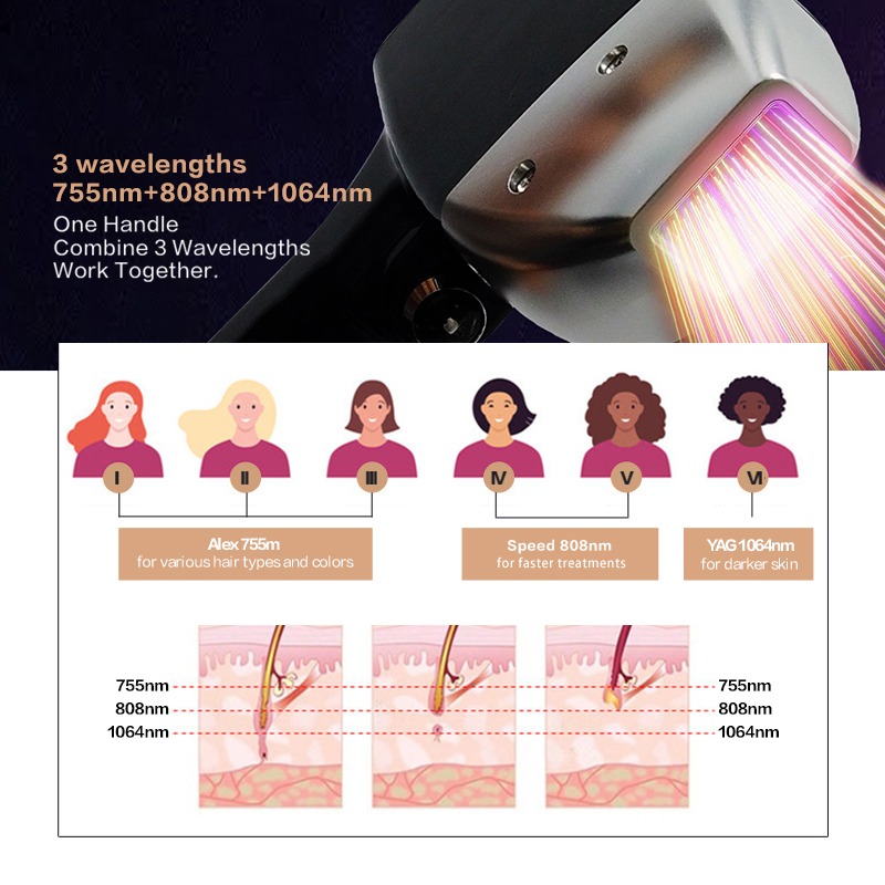 Yüksek Güçlü Titanyum Lazer 12 - Ice Titanium Diode Laser Machine incelemesi ve fiyatı