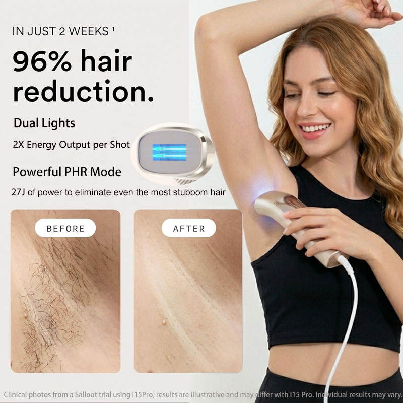 Trinity I15 Pro Safir Buz Soğu - Home Ipl Hair Removal Sapphire Cooling incelemesi ve fiyatı
