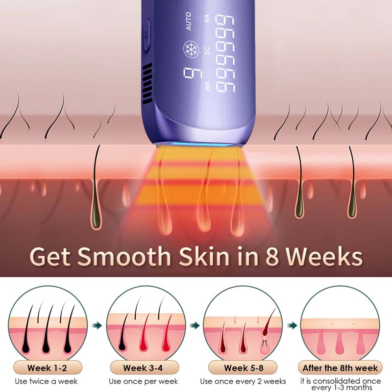 Mini Buz Soğutmalı IPL Epilasy - Ipl Hair Removal Handset Permanent incelemesi ve fiyatı