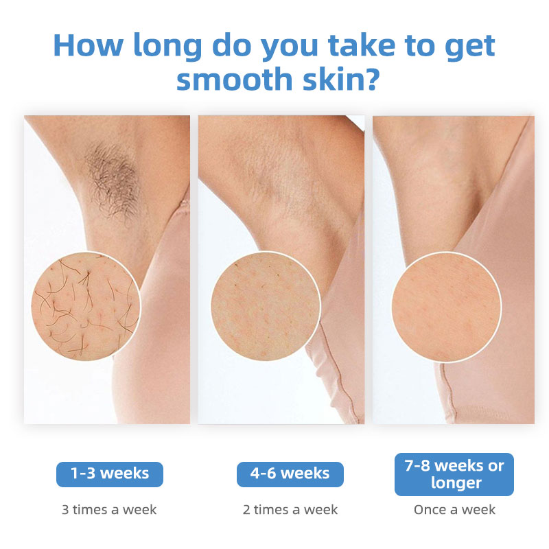 IShine Sapphire Ice Cooling IP - Home Ipl Hair Removal Sapphire Cooling incelemesi ve fiyatı