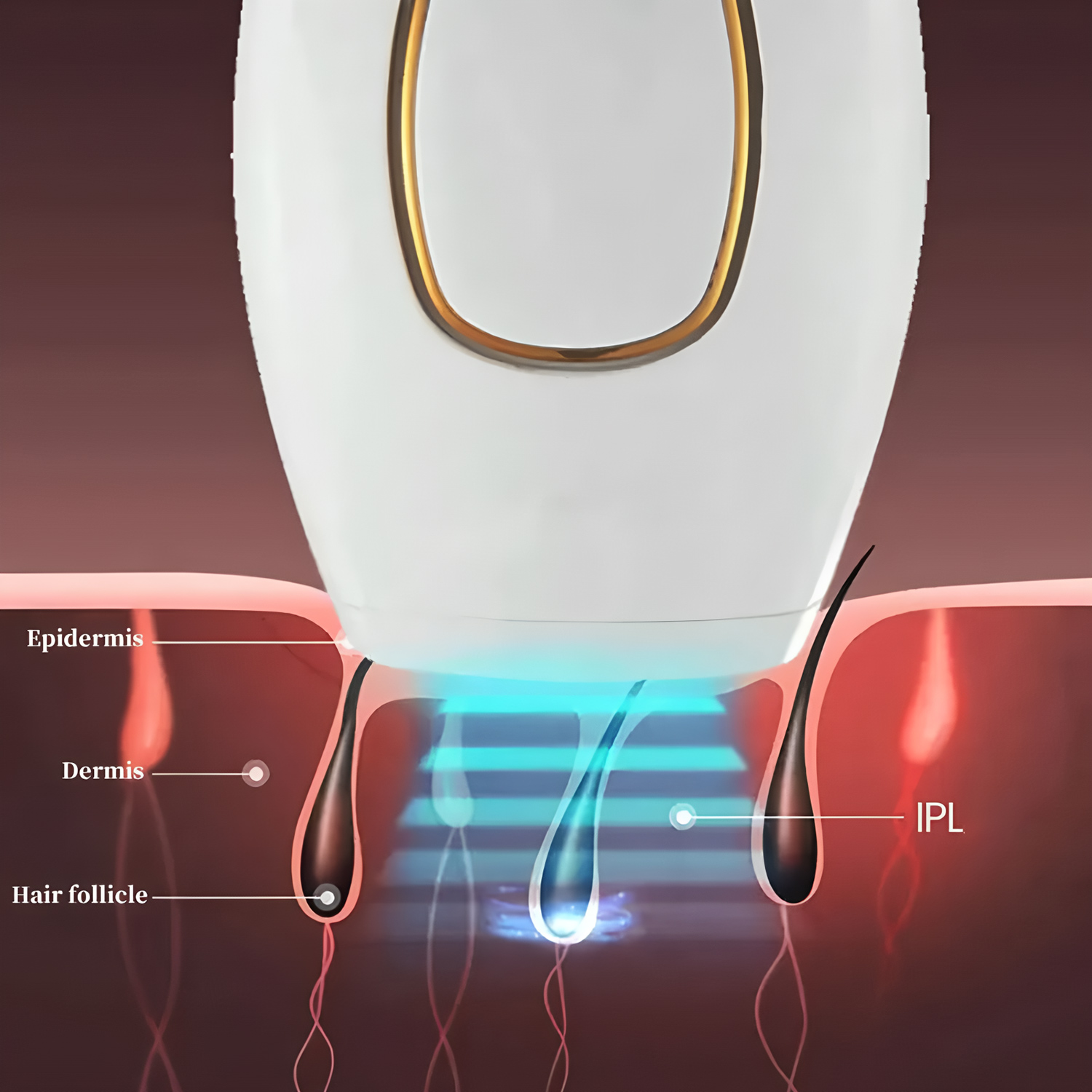 Lazer Epilatör, IPL ile Tüyler - Opt Ipl Laser Hair Removal Machine incelemesi ve fiyatı